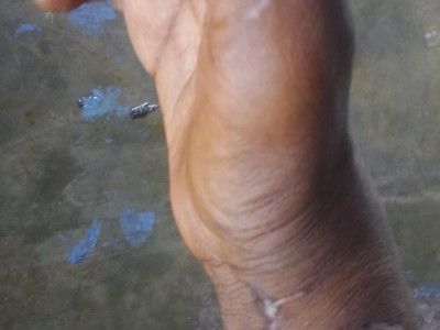 We Need Your Help After a Tragic Hand Injury: Support Our Family After a Life-Changing Accident