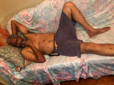 Dad with Kidney issues