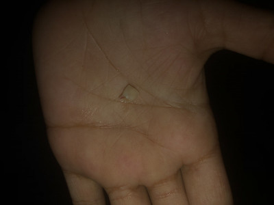 Dental