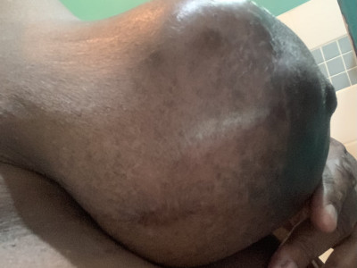 Medical bills and surgery